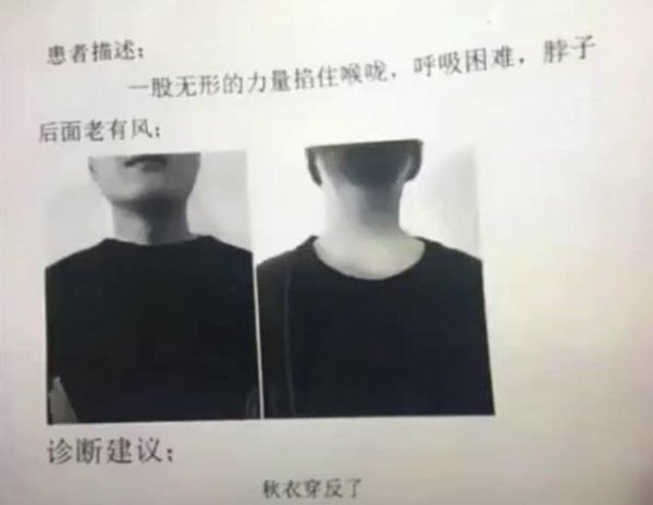 方圆之道 男子双手发黑以为患上血栓，医生一检查哭笑不得...